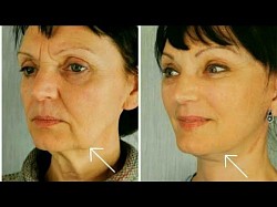 Naturally You Neck and Chin Herbal Solution